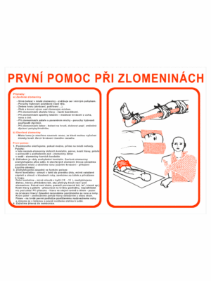 Pravidla první pomoci - První pomoc při zlomeninách